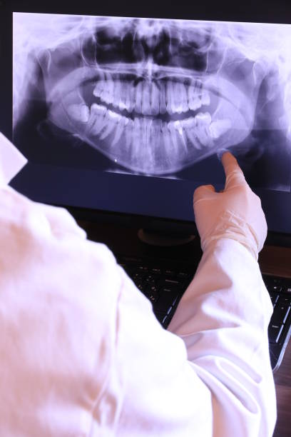 Best Emergency Treatment for Toothache in Deale, MD