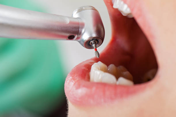 Best Emergency Dental Care for Trauma or Injury in Deale, MD